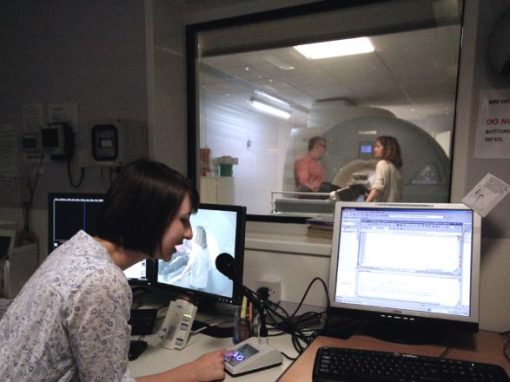 Aligning Dimensions of Interoceptive Experience ADIE to Prevent Development of Anxiety Disorders in Autism
