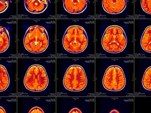 What Brain Patterns Reveal About Mental Health