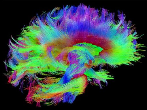 What Happens in the Brain When Symptoms of Schizophrenia Arise?