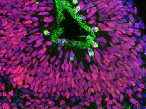 Can Using Stem Cells to Recreate Part of the Human Brain Reveal the Causes of Schizophrenia?