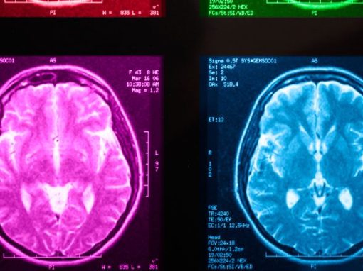 How Are Brain Cells Affected When Traumatic Memories Are Removed?